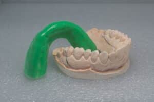 mouthguards marysville