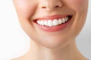 teeth whitening Marysville